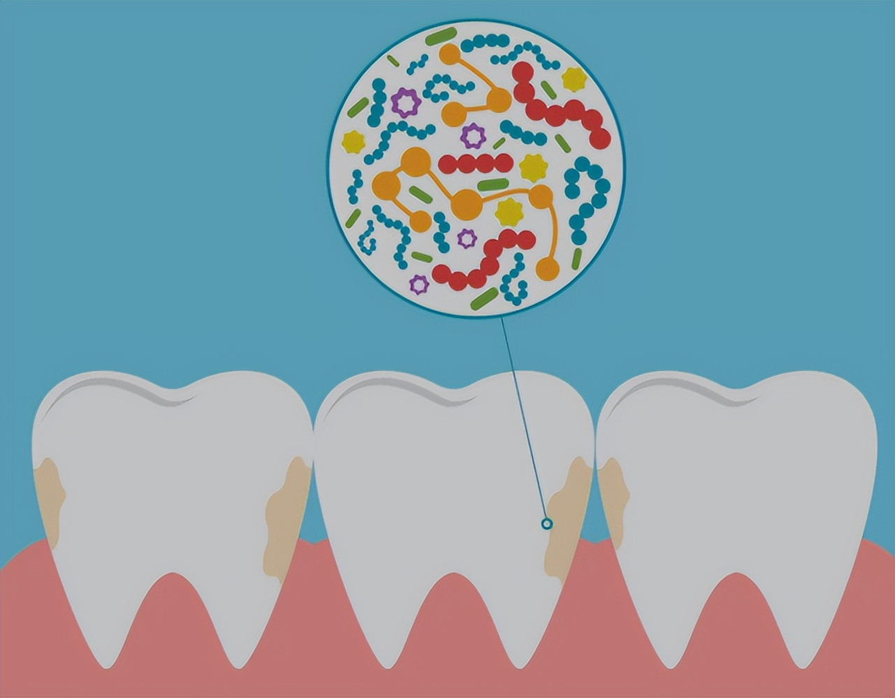 一瓶“甲硝唑”几块钱，或能“摆平”5种常见疾病，你知道几个？