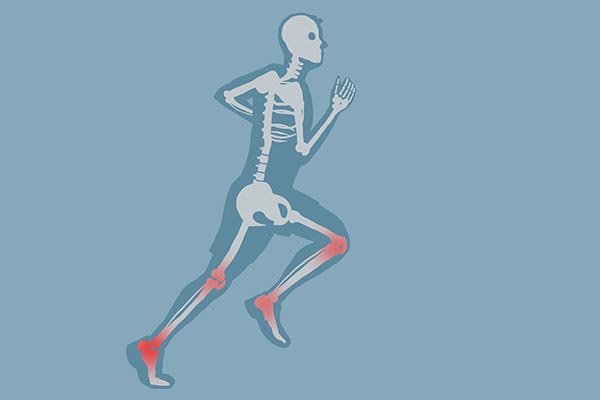 囊肿到底是什么病,囊肿属于炎症还是肿瘤