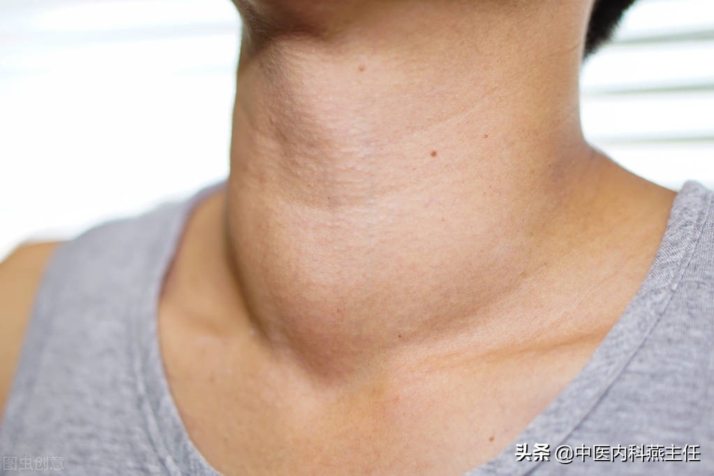 甲状腺为什么会弥漫病变,甲状腺肿如何产生