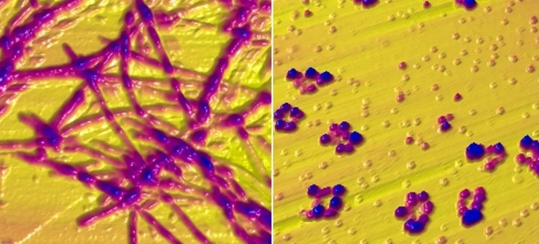 世界帕金森病日第28个主题,世界帕金森病日完整版