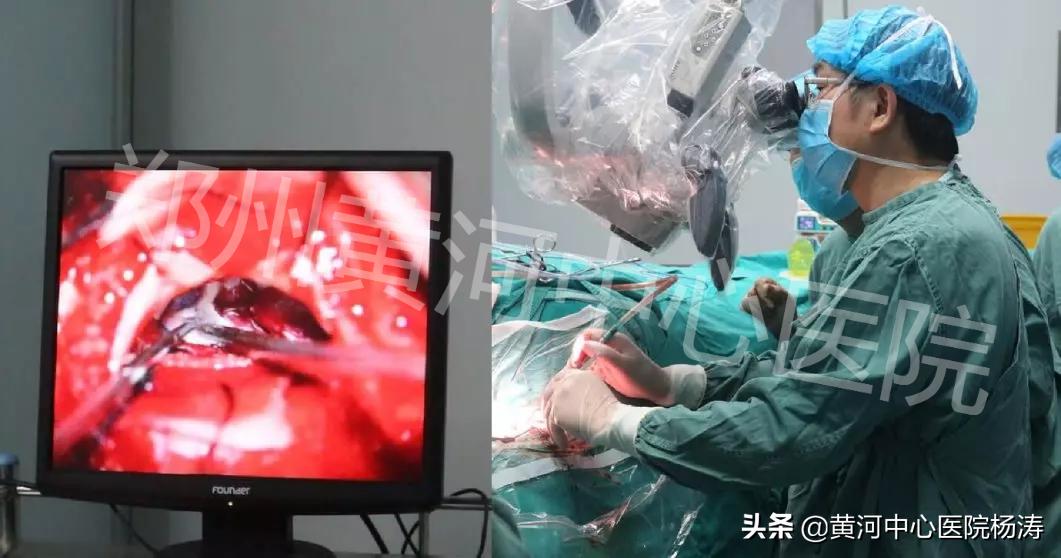 河南卫视新闻报道：眼睛抽动，不是跳灾可能是病