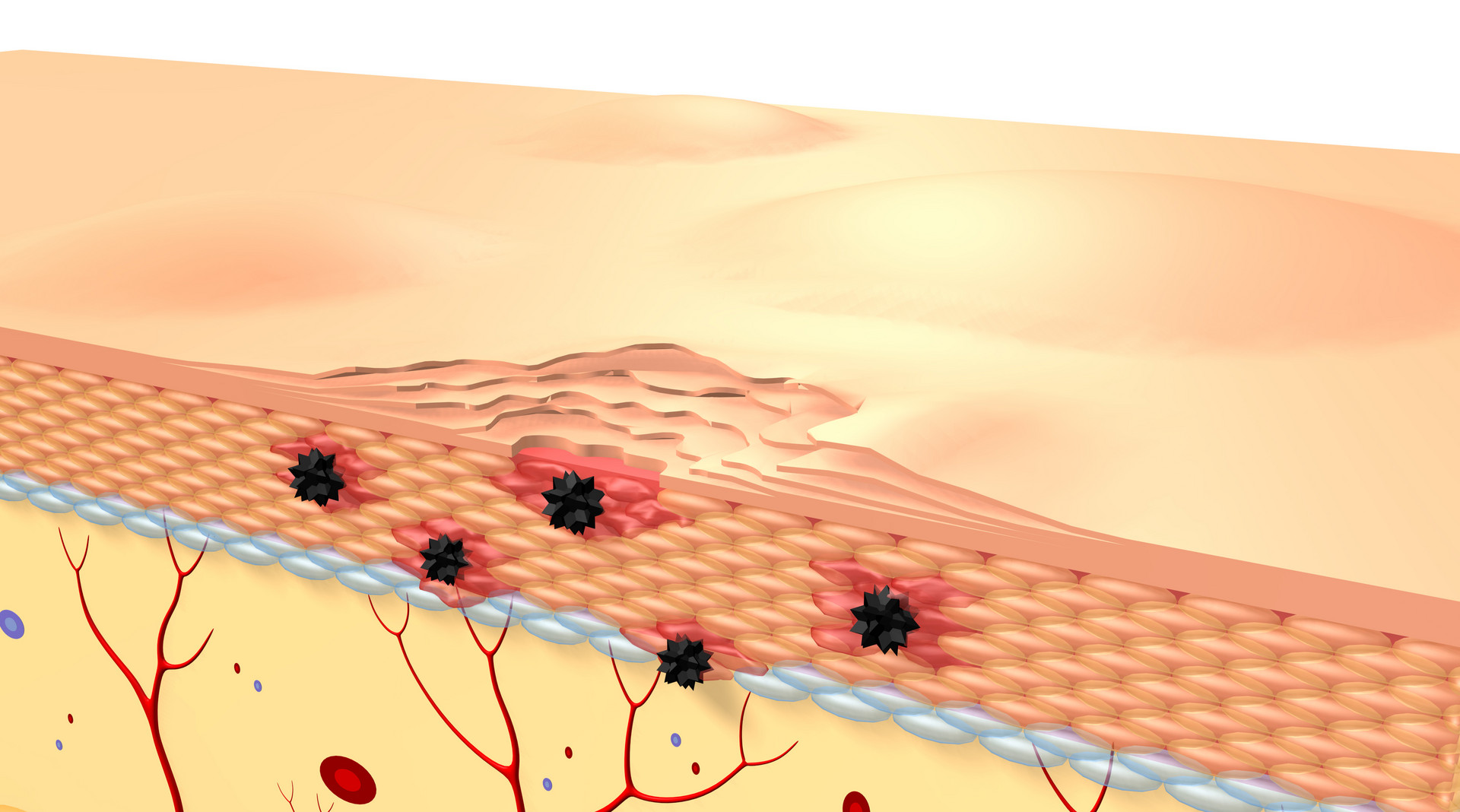 放疗皮肤防护剂有效果吗,放疗皮肤破损应用什么药