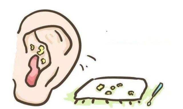 肚脐眼的黑泥到底可不可以抠,人体的秘密全部视频