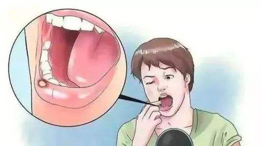 最适合放疗的癌症,哪种肿瘤需要放疗