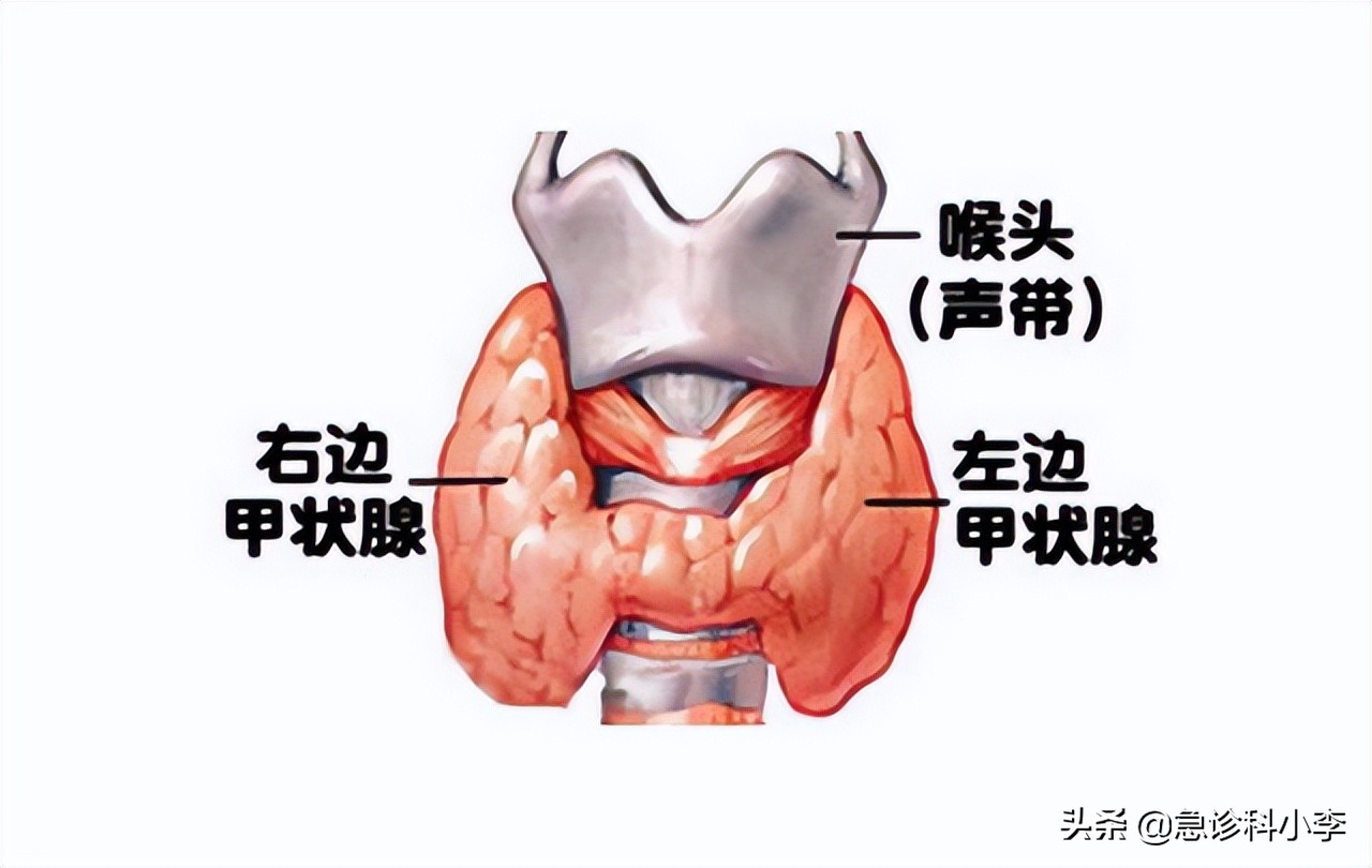 桥本氏甲状腺结节治疗的最好方法,甲状腺结节5级恶性还能治疗好吗