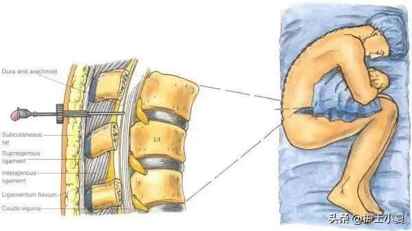 开十指有多疼,开十指代表多痛