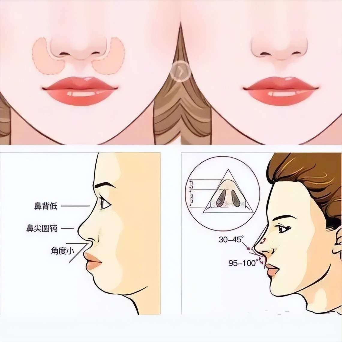 上海九院韦敏轮廓做得好吗,九院韦敏做鼻子好吗