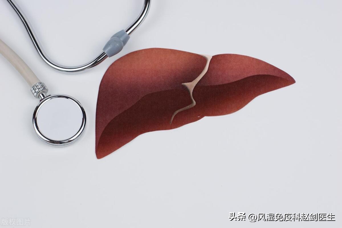 治疗类风湿不伤肝的最佳药物,类风湿药4大禁忌