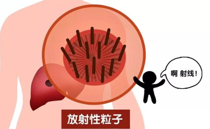 不用开刀的手术是什么手术,不用开刀手术可以治好吗