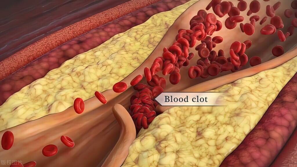 老年人打吊针补充能量,老年人打疏通血管针一年两次好吗