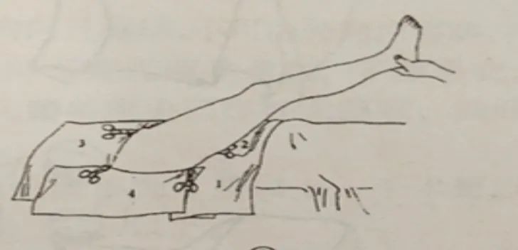 外科手术消毒、铺巾操作，做好这几个细节事半功倍