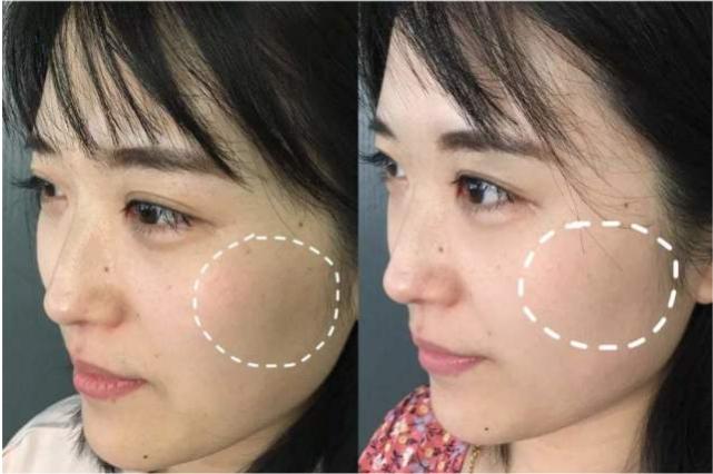 黄皮女生的护肤品,黄皮女生适合用什么护肤品