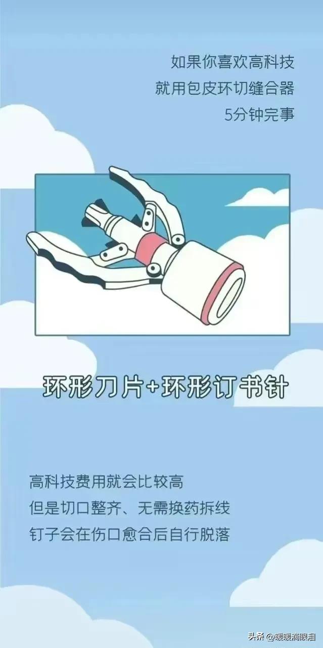 正经科普男人割“包皮”的那点事儿！