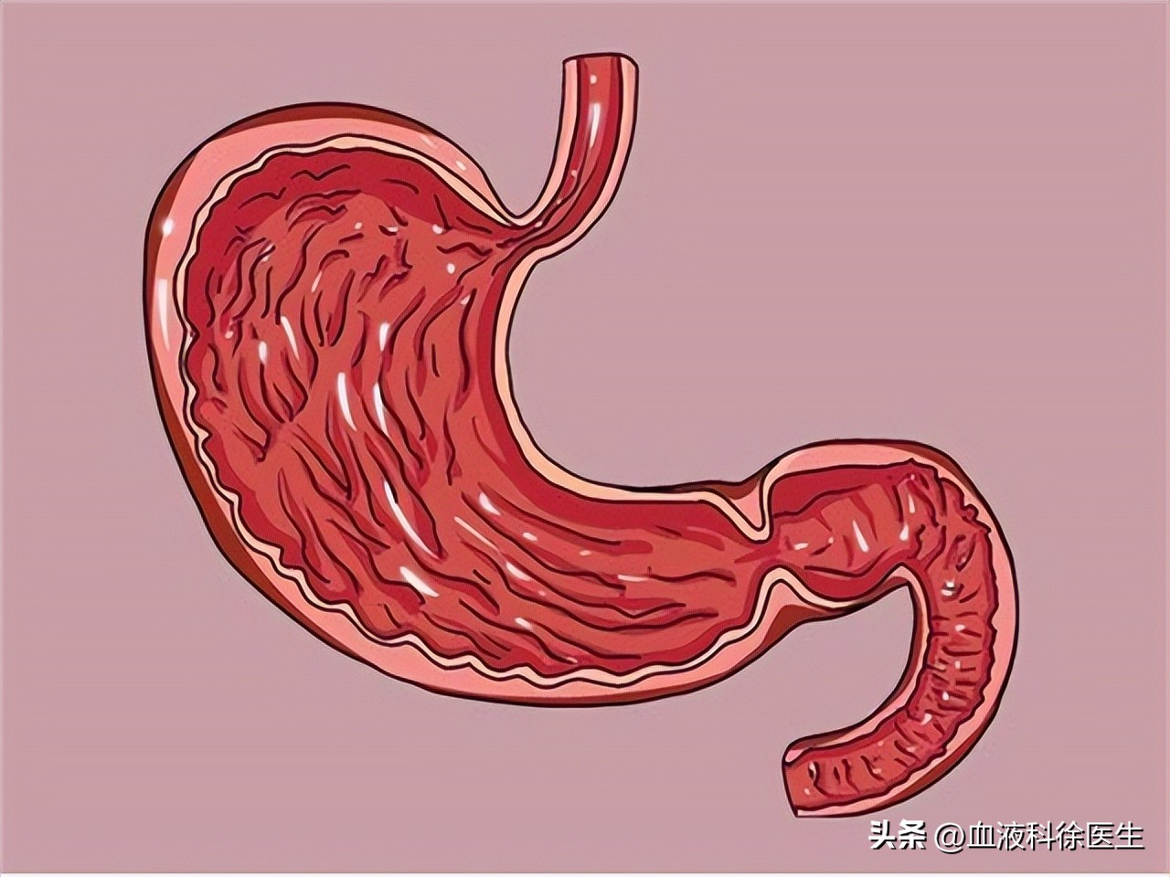 中老年补充叶酸每日需多少,中老年人如何补充叶酸每次吃多少