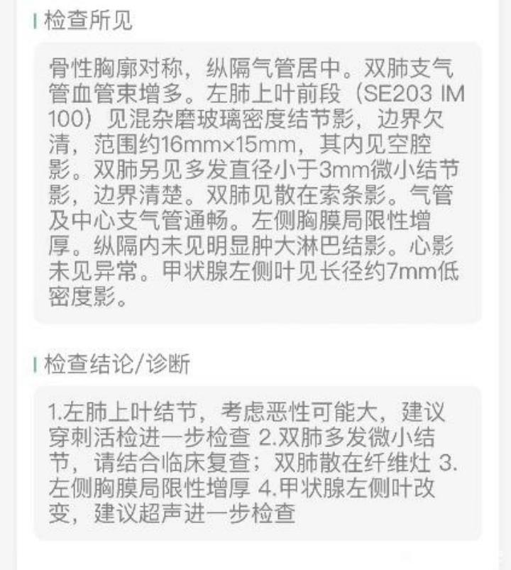 3个月内磨玻璃结节,多发磨玻璃结节3个月后减少