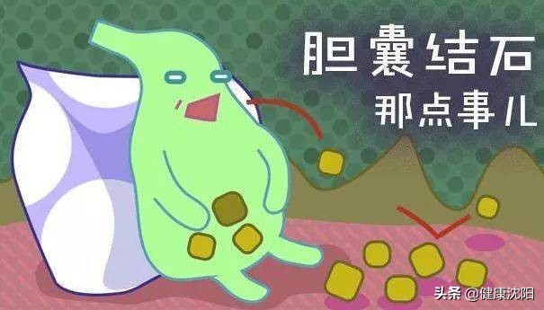 全家都有胆囊结石是怎么回事,医生说我有胆囊结石怎么办