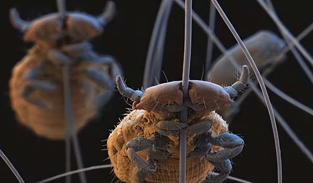 男子腹部痒,男性大量阴虱和虫卵