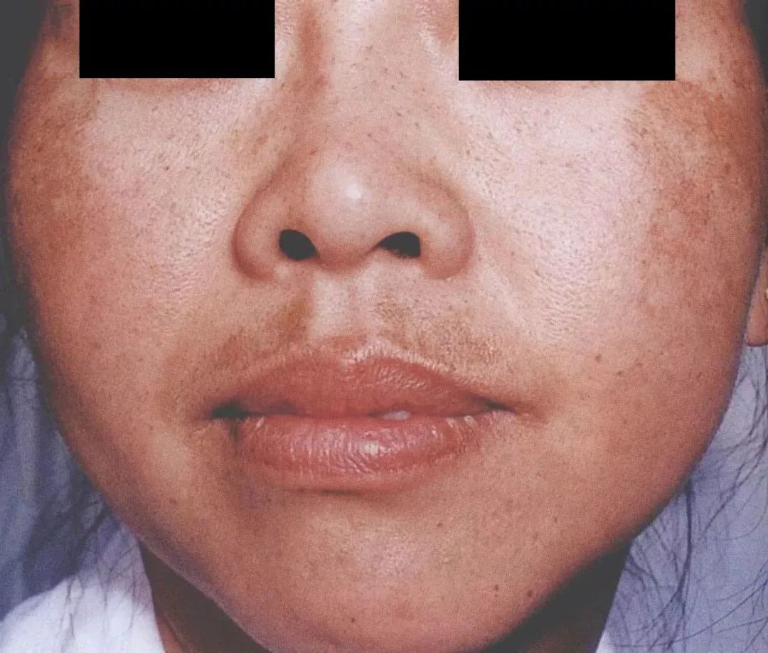 养成干净脸的最好方法,养成干净脸