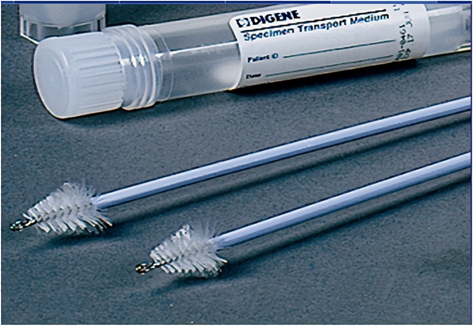 宫颈癌的4个常识,宫颈癌很可怕三个步骤教你预防