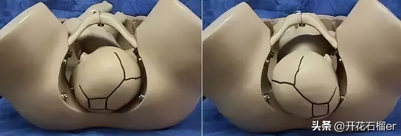 胎儿几个月容易胎停,怀孕胎位不正多少周定胎位好一点