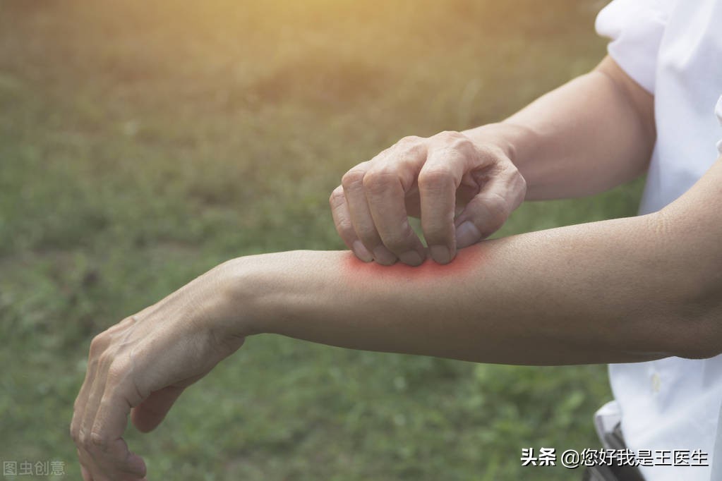 孩子湿疹反复记住这三招,孩子湿疹反复怎么食疗