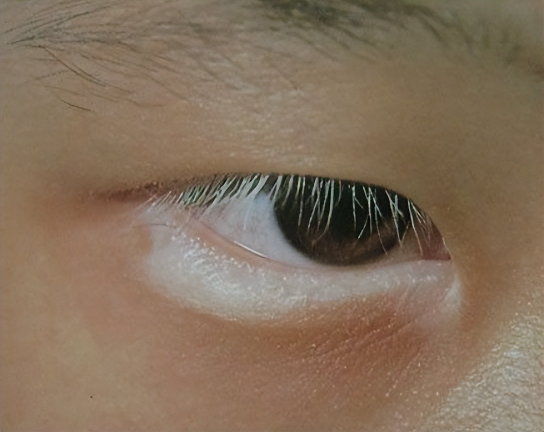 阴毛有何作用？要刮掉吗？从黑变白表示着什么？不要羞于了解