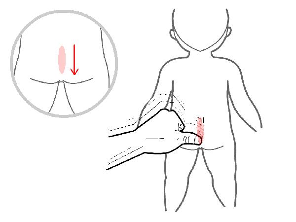 便秘不用愁舌象告诉你如何调理,便秘不吃药最快的一招通便