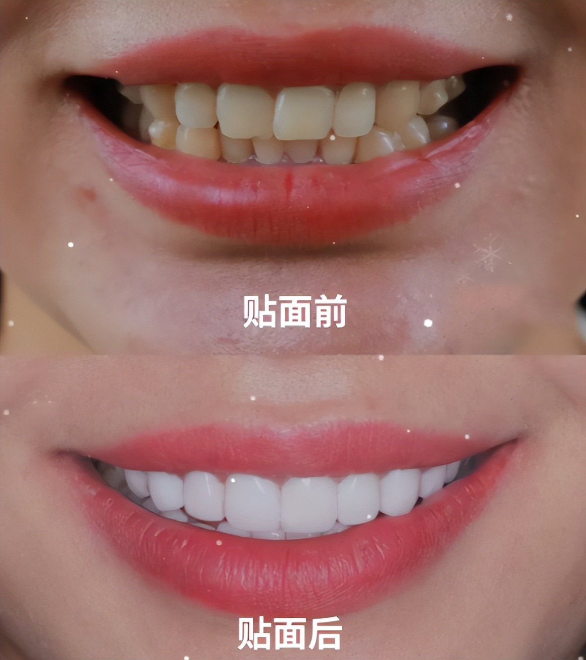 牙齿美白神器真的靠谱吗,牙齿美白产品测评真实有效