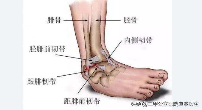 内马尔脚踝90度扭曲治疗,内马尔脚踝90度扭曲拉莫斯