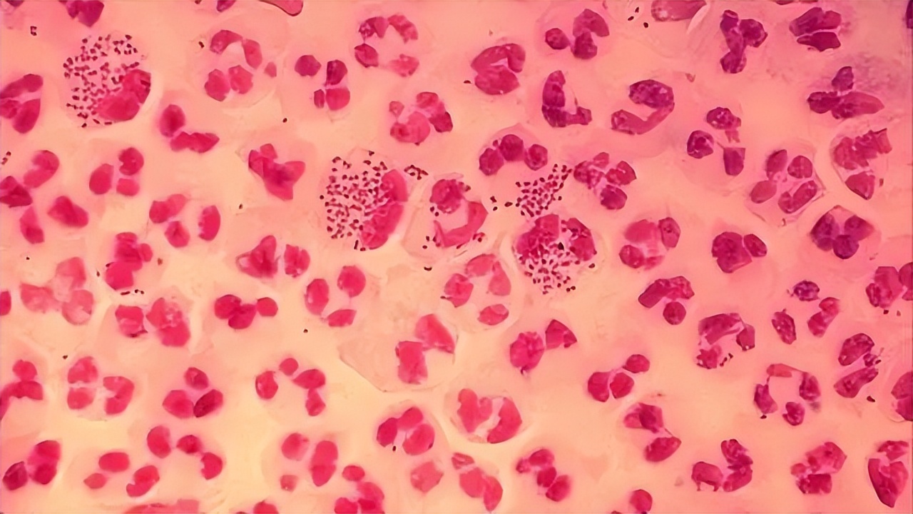 嘴上出了好多透明水泡会传染吗,嘴上起水泡是什么原因传染吗