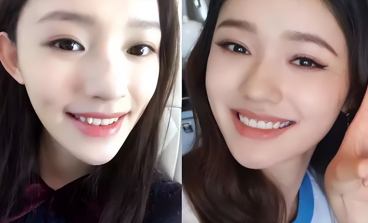 衣不蔽体,全身涂白,满口假牙闪瞎眼…娱圈的病态审美,该管管了