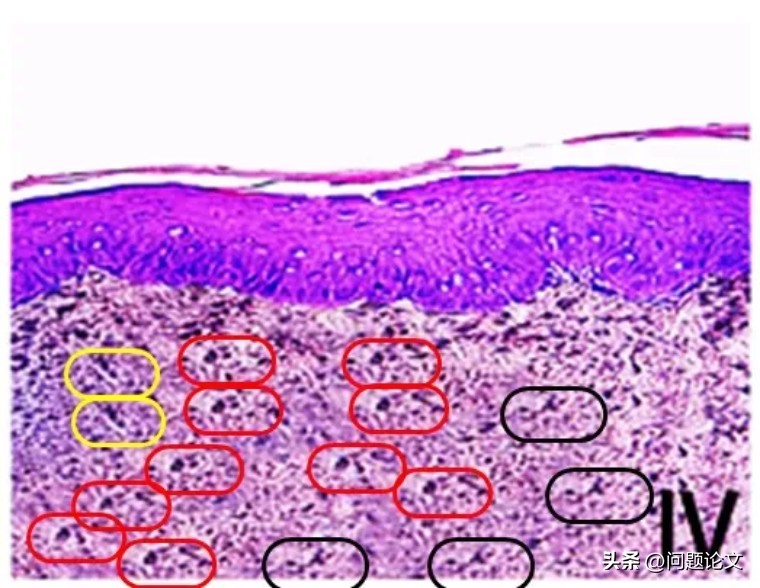医生学术论文作假严重吗,国外承认中医论文造假事件