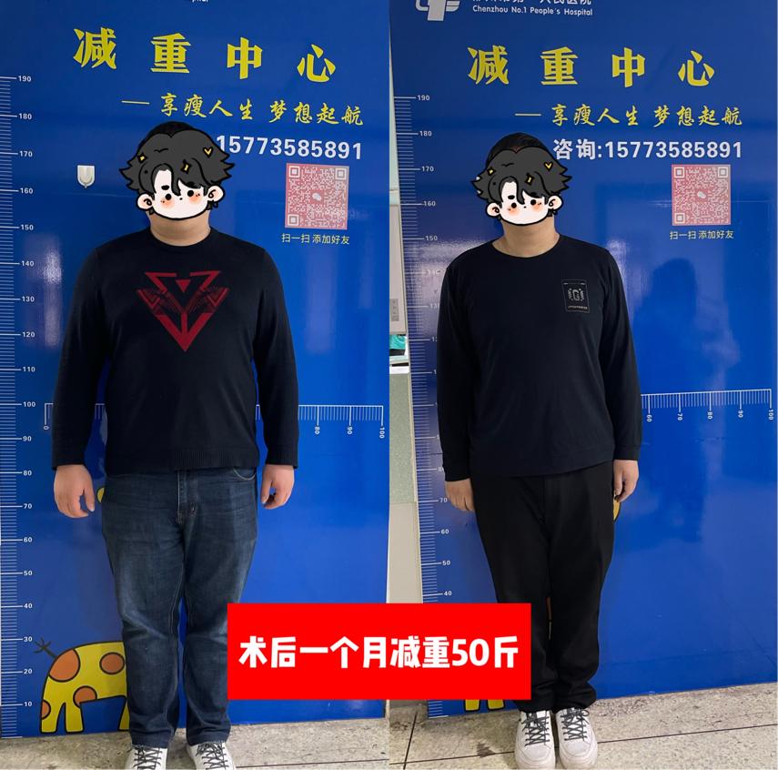 【5.11中国肥胖日】“减重手术”让你不再负“重”前行