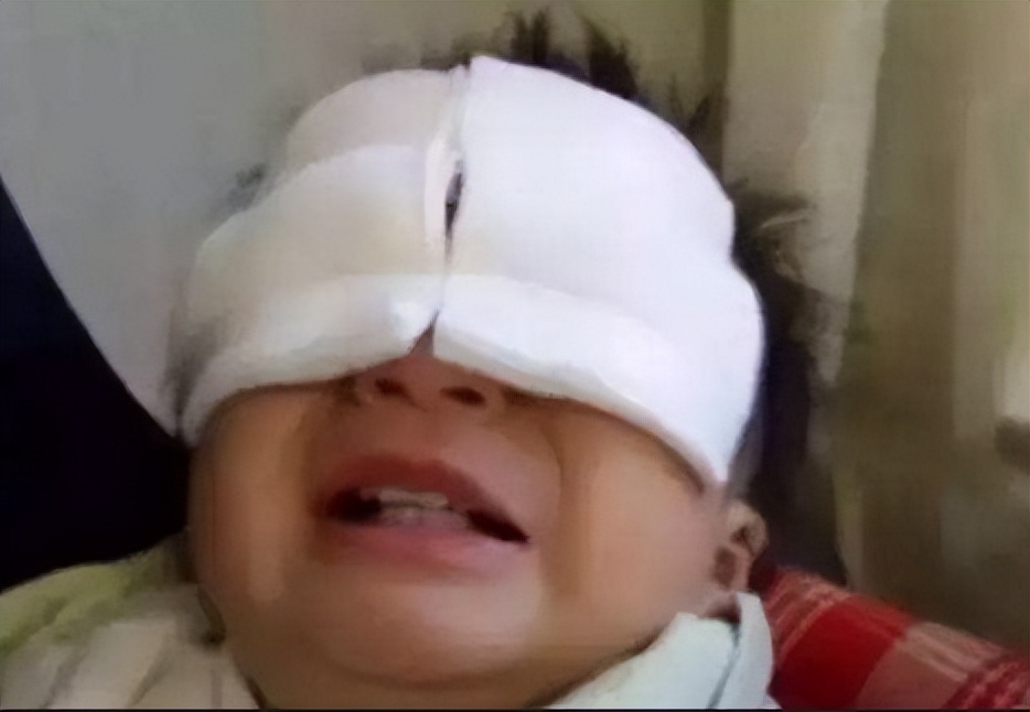 八岁男孩眼球被溶解,20分钟孩子眼球溶化无力回天