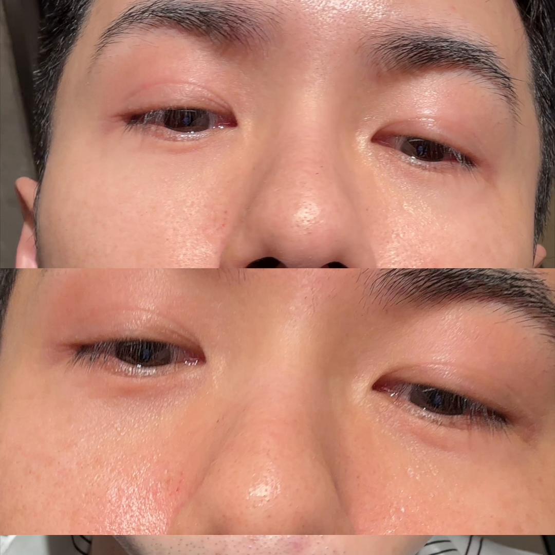 咖啡渣去黑眼圈的调配,咖啡渣椰子油去黑眼圈