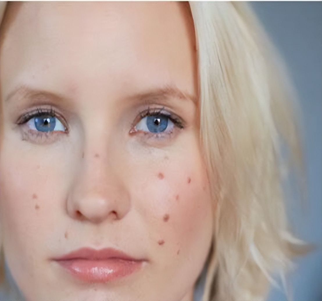 排出体内长期粪便宿便的最好方法,人体内的宿便可以清除吗