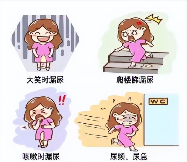 关爱女性关注盆底健康,市人民医院关爱女性健康