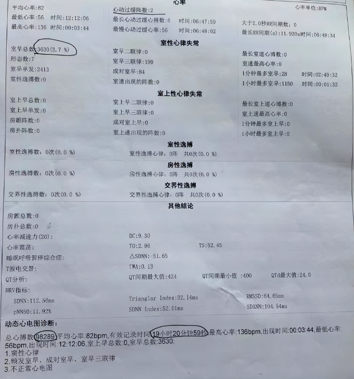 年轻女性心慌心律不齐什么原因,母亲心率慢如何治疗