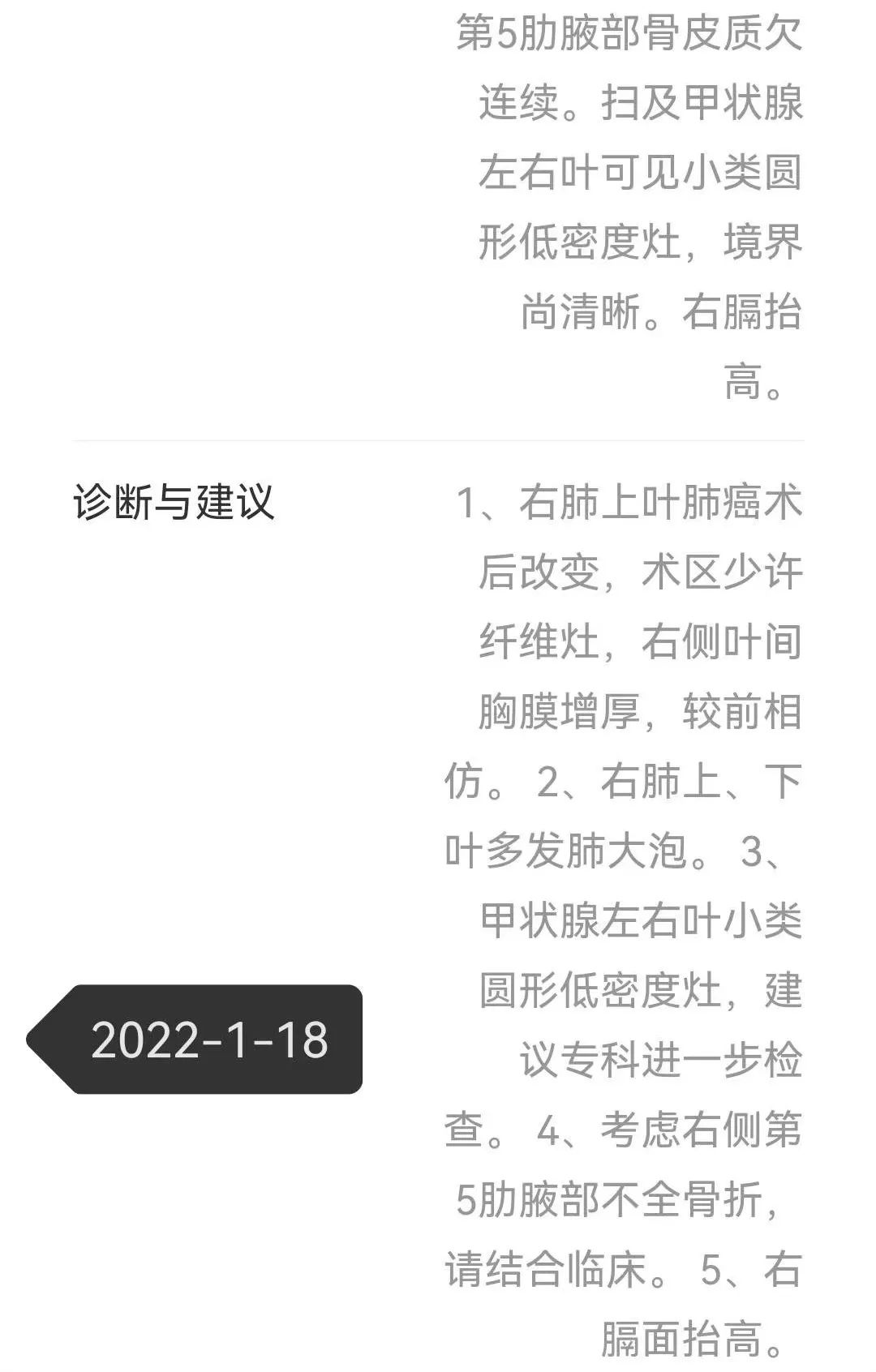 晚期肺癌偏方,2022晚期肺癌治疗指南