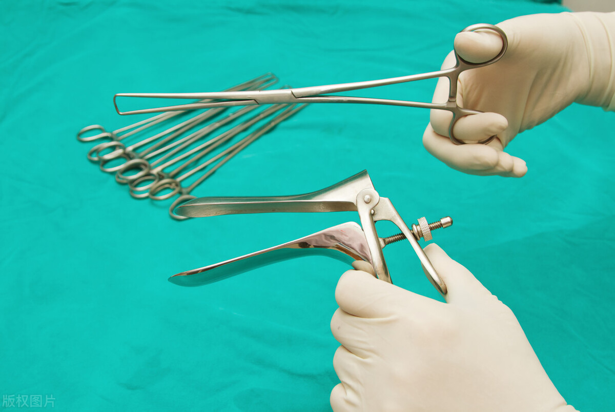 女性不容忽视的老病—盆腔脏器脱垂