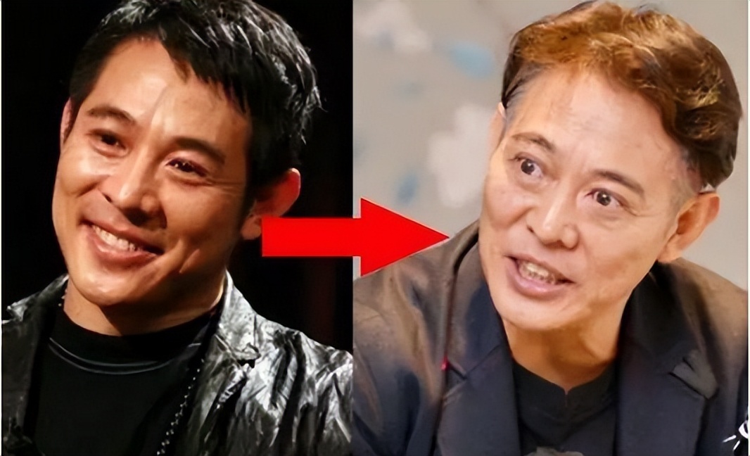 李连杰得甲亢后的照片,李连杰得甲亢前后照片对比