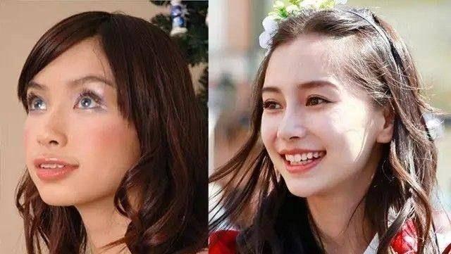 塌山根塌鼻梁怎么拯救,没山根塌鼻梁凸嘴怎么改善