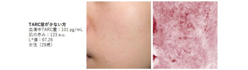 日本pola美容,pola新款美白水乳