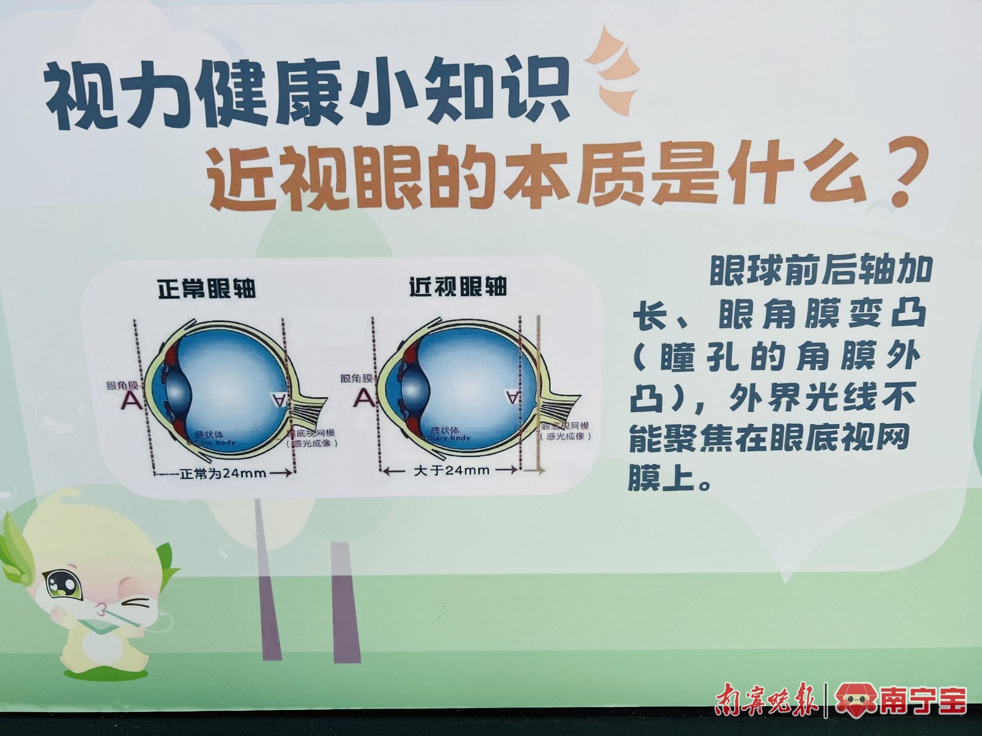 孩子用眼过度怎么保护眼睛疲劳,避免过度用眼关注孩子视力发育