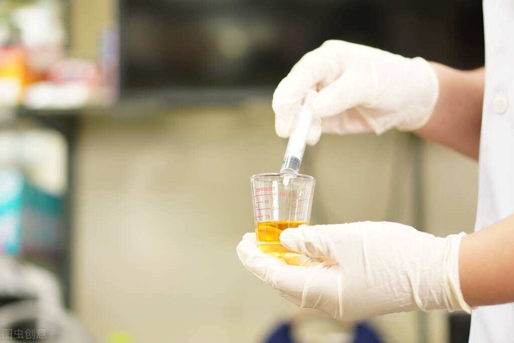 肾积水终极3问：一文解答肾积水患者90%的困惑