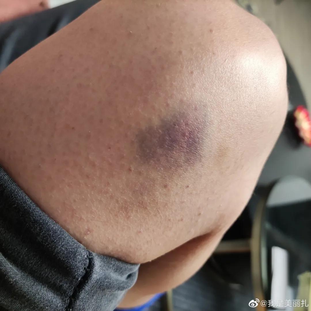 山东鲁能成源打人处置是否合理,遭成源殴打女子发声