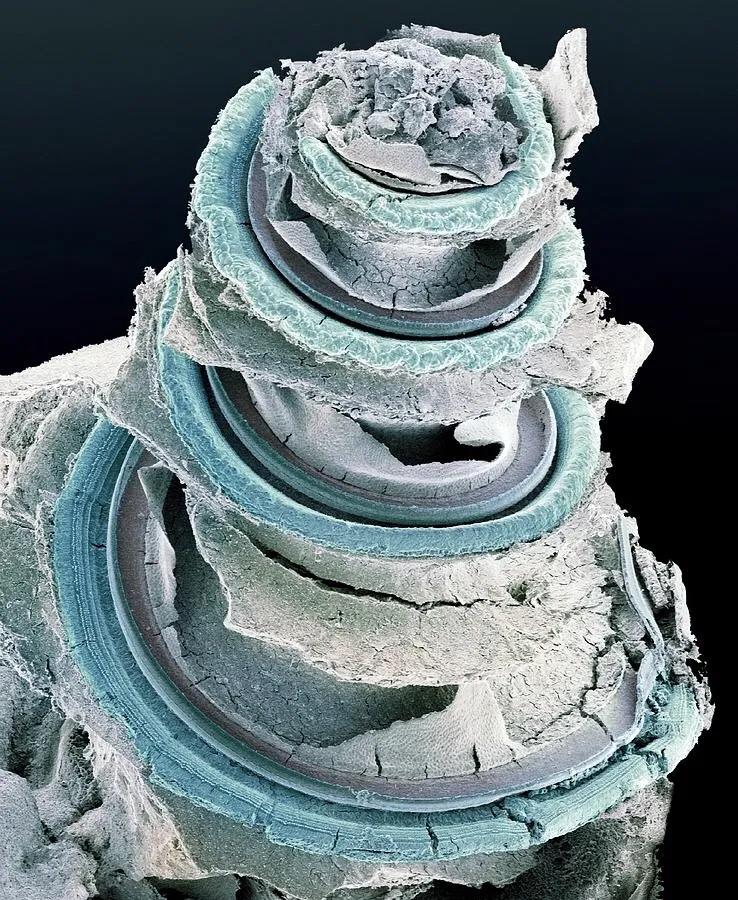 显微镜观察人体的四种组织图片,人体显微镜下的样子