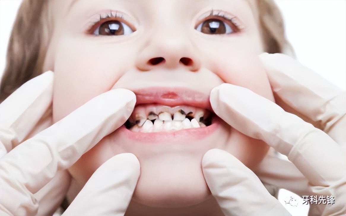 家长必知的儿童口腔知识,健康宣教口腔知识