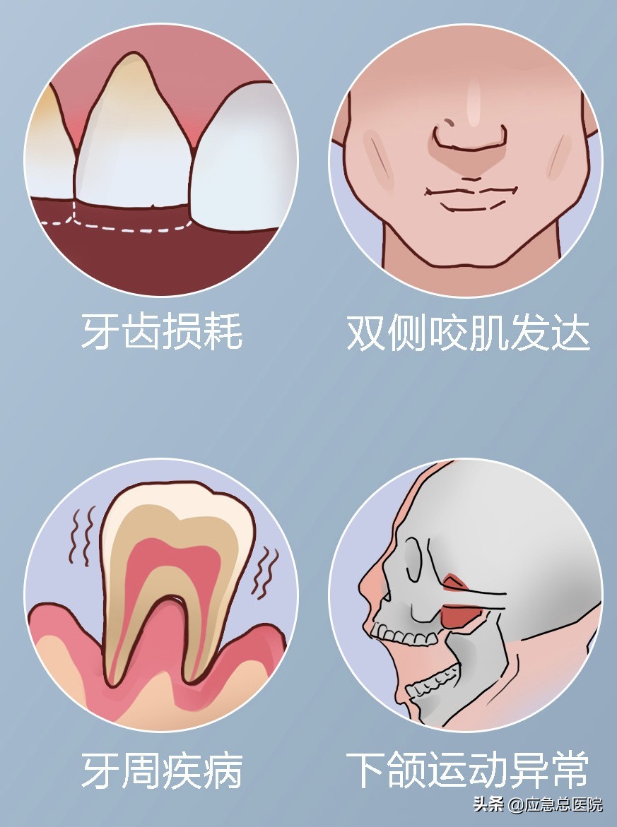 晚上睡觉磨牙是病吗,兔磨牙是什么病