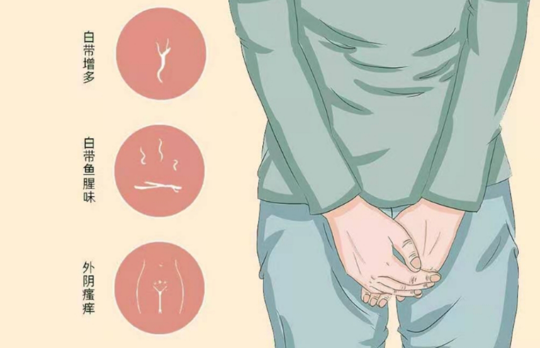 阴道疾病都是“拖”出来的？医生：有这3个行为的要注意了